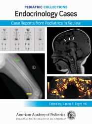 Pediatric Collections : Endocrinology Cases: Case Reports from Pediatrics in Review