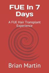 FUE in 7 Days : A FUE Hair Transplant Experience