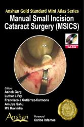 Manual Small Incisions in Cateract Surgery (MSICS)