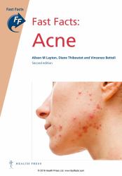 Acne