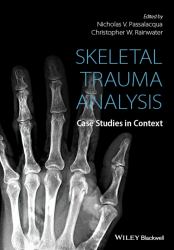 Skeletal Trauma Analysis : Case Studies in Context