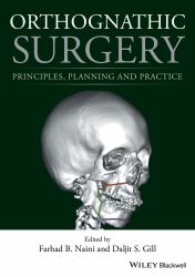 Orthognathic Surgery : Principles, Planning and Practice