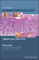 Atlas of Dermatopathology : Tumors, Nevi, and Cysts
