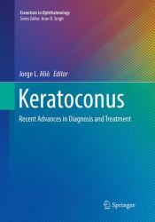 Keratoconus : Recent Advances in Diagnosis and Treatment