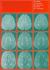 Magnetic Resonance in Multiple Sclerosis
