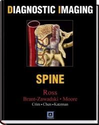 Spine