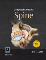 Diagnostic Imaging: Spine