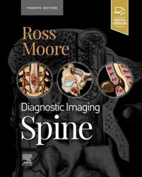 Diagnostic Imaging: Spine