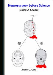 Neurosurgery Before Science : Taking a Chance