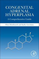Congenital Adrenal Hyperplasia : A Comprehensive Guide