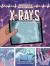 X-Rays : A Graphic History