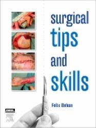 Surgical Tips and Skills