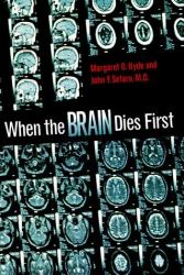 When the Brain Dies First