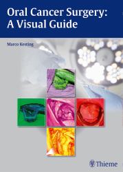 Oral Cancer Surgery : A Visual Guide