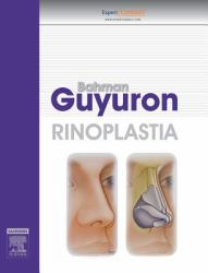 Rinoplastia