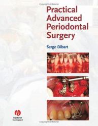 Practical Advanced Periodontal Surgery