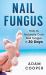 Nail Fungus: How to Naturally Cure Nail Fungus in 30 Days : Natural Remedies, Homeopathy for Toenail Fungus