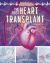 The First Heart Transplant : A Graphic History