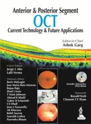 OCT : Anterior & Posterior Segment Current Technology & Future Applications