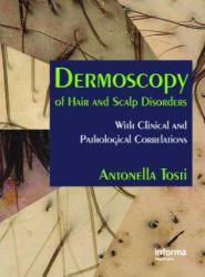 Dermoscopy of Hair and Scalp Disorders : Pathological and Clinical Correlations