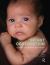 Infant Observation Infant Observation