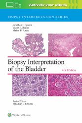 Biopsy Interpretation of the Bladder: Print + EBook with Multimedia