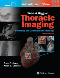 Webb and Higgins Thoracic Imaging - Print + EBook with Multimedia