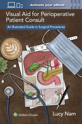Visual Aid for Perioperative Patient Consult : An Illustrated Guide to Surgical Procedures
