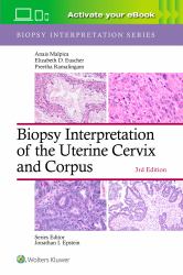 Biopsy Interpretation of the Uterine Cervix and Corpus: Print + EBook with Multimedia