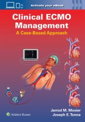 Clinical ECMO Management : A Case-Based Approach