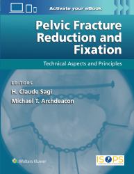 Pelvic Fracture Reduction and Fixation : Technical Aspects and Principles