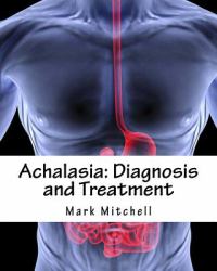 Achalasia: Diagnosis and Treatment