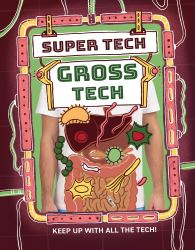 Gross Tech
