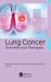 Lung Cancer : Overview and Therapies