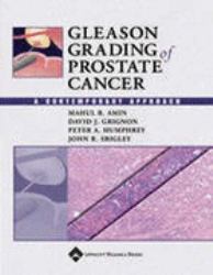 Gleason Grading of Prostate Cancer : A Contemporary Approach