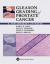 Gleason Grading of Prostate Cancer : A Contemporary Approach Gleason Grading of Prostate Cancer : A Contemporary Approach