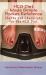 HCG Diet Made Simple Pocket Reference : Charts and Checklists for the HCG Diet