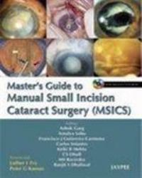 Masters Guide to Manual Small Incision