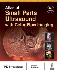 Atlas of Small Parts Ultrasound : With Color Flow Imaging