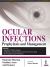 Ocular Infections : Prophylaxis and Management Ocular Infections : Prophylaxis and Management
