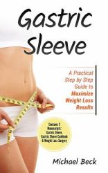 Gastric Sleeve : A Practical Step by Step Guide to Maximize Weight Loss Results (Contains 3 Manuscripts: Gastric Sleeve, Gastric Sleeve Cookbook and Weight Loss Surgery)