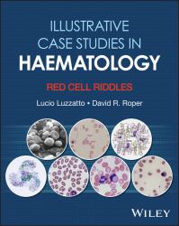 Illustrative Case Studies in Haematology : Red Cell Riddles