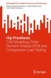 Hip Prosthesis : CAD Modeling, Finite Element Analysis (FEA) and Compressive Load Testing