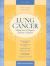 Lung Cancer: Making Sense of Diagnosis, Treatment, and Options : Making Sense of Diagnosis, Treatment, and Options Lung Cancer: Making Sense of Diagnosis, Treatment, and Options : Making Sense of Diagnosis, Treatment, and Options
