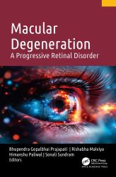 Macular Degeneration : A Progressive Retinal Disorder