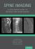 Spine Imaging : A Case-Based Guide to Imaging and Management