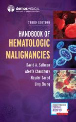 Handbook of Hematologic Malignancies