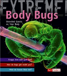 Body Bugs! : Uninvited Guests on Your Body