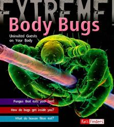 Body Bugs! : Uninvited Guests on Your Body