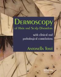 Dermoscopy of Hair and Scalp Disorders